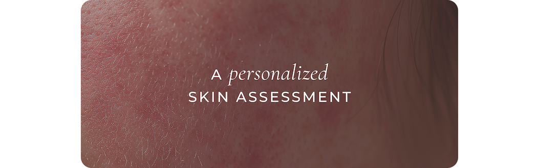 Le Mieux skin assessment illustration from original campaign
